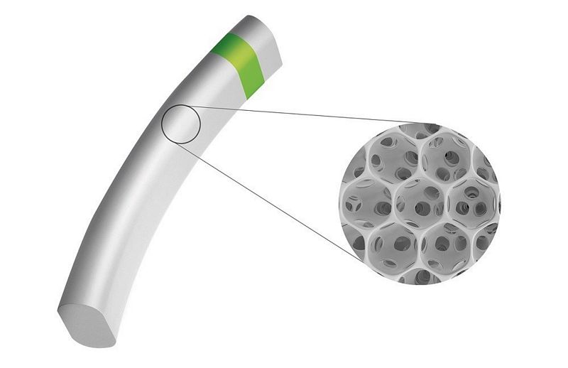 iSTAR Medical’s glaucoma device MINIject shows positive one-year results in European trial